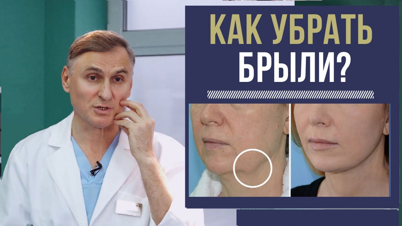 👍🔥КАК УБРАТЬ БРЫЛИ: БЕЗОПЕРАЦИОННЫЕ МЕТОДЫ И ПЛАСТИКА
