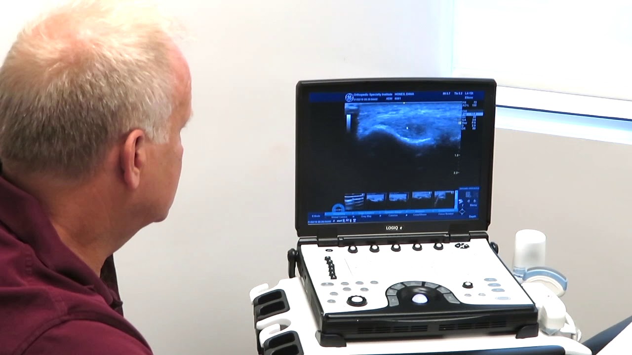 Tennis Elbow Ultrasound Assessment with PRP injection.