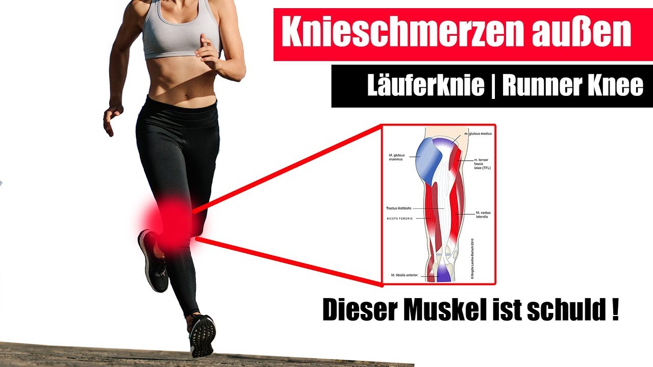 Knieschmerzen außen, Läuferknie | Die 3 besten Übungen für Läufer