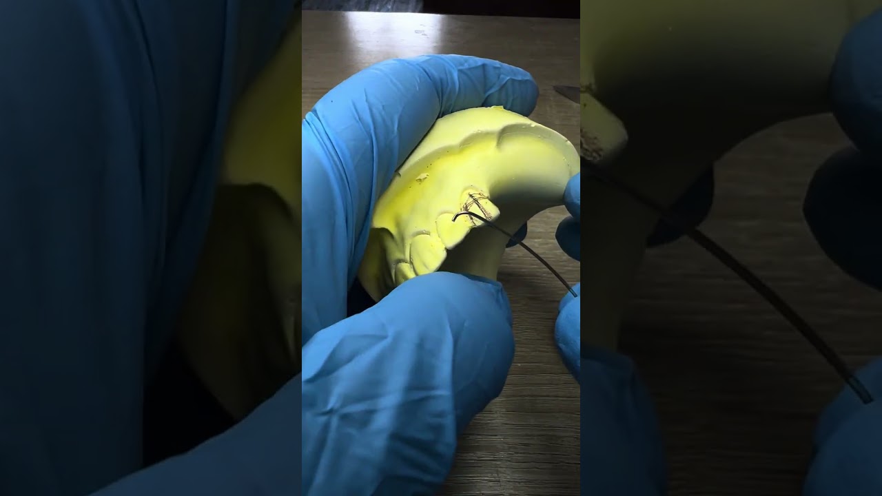 بارشل دنجر طريقة صنع الكلاسب partial denture , clasp c