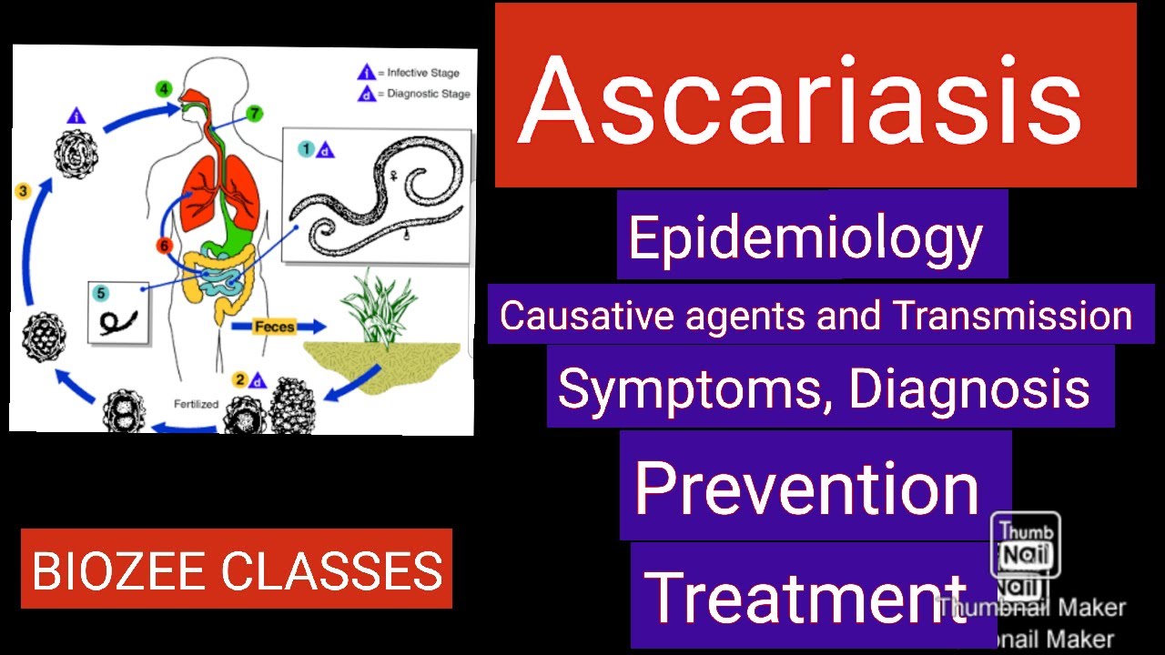 ASCARIASIS: EPIDEMIOLOGY, CAUSATIVE AGENTS & TRANSMISSION, SYMPTOMS, DIAGNOSIS, PREVENTION&TREATMENT