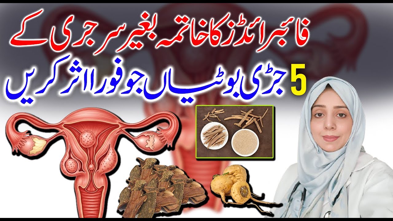 Struggling with Uterine Fibroids? 5 Natural Herbs That Can Shrink Them Fast! || Home Remedy