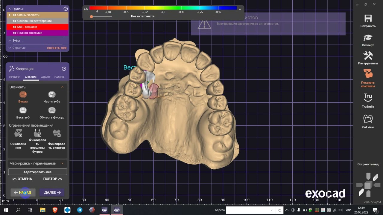 sdfa to stl Exocad3