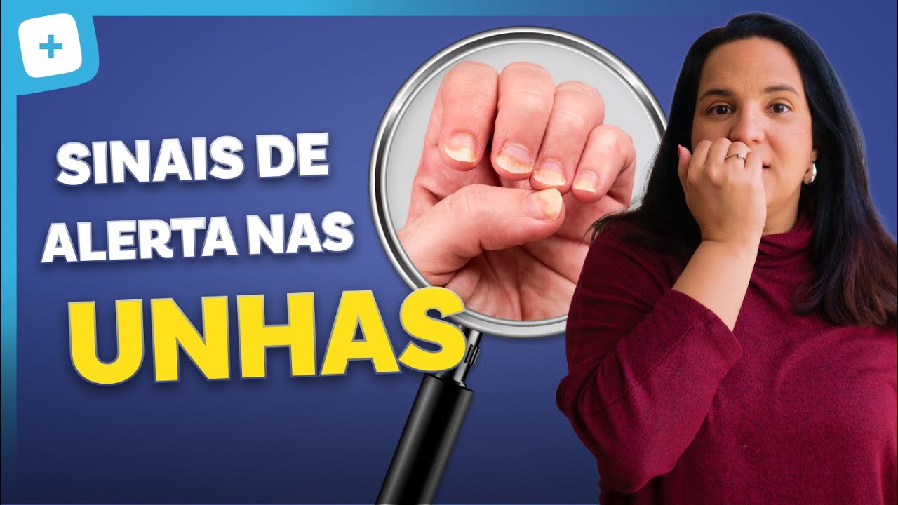 10 Alterações nas Unhas Que Indicam Problemas de Saúde