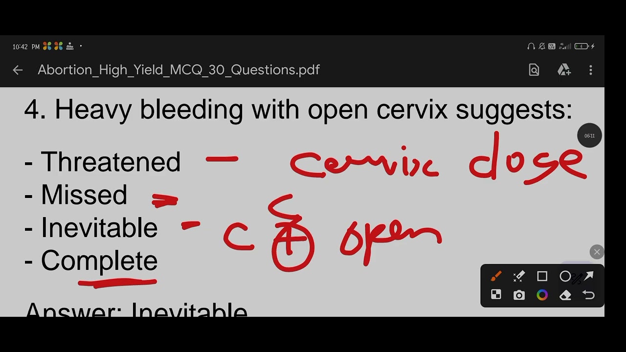 Abortion related important MCQ question for any compititive exam 