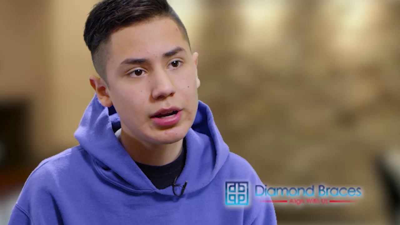 Diamond Braces Patient Reviews Treatment
