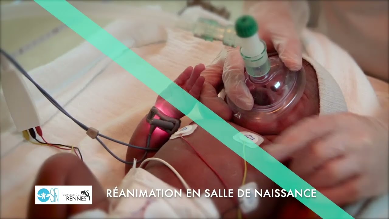 Réanimation du nouveau-né en salle de naissance 2022 : A1 Préparation  position