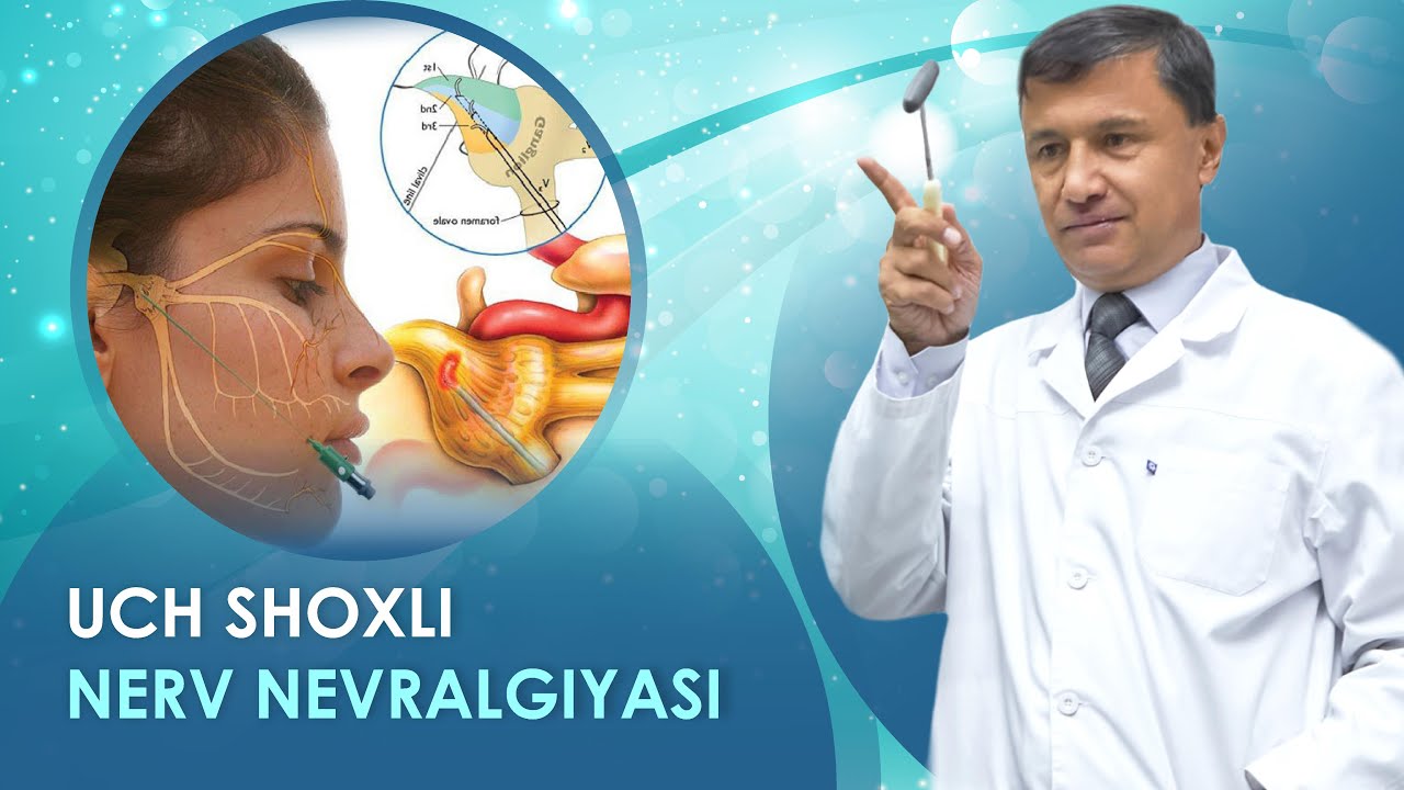 Uch shohli nerv nevralgiyasi qo‘rqinchli emas, da’vosi bor!