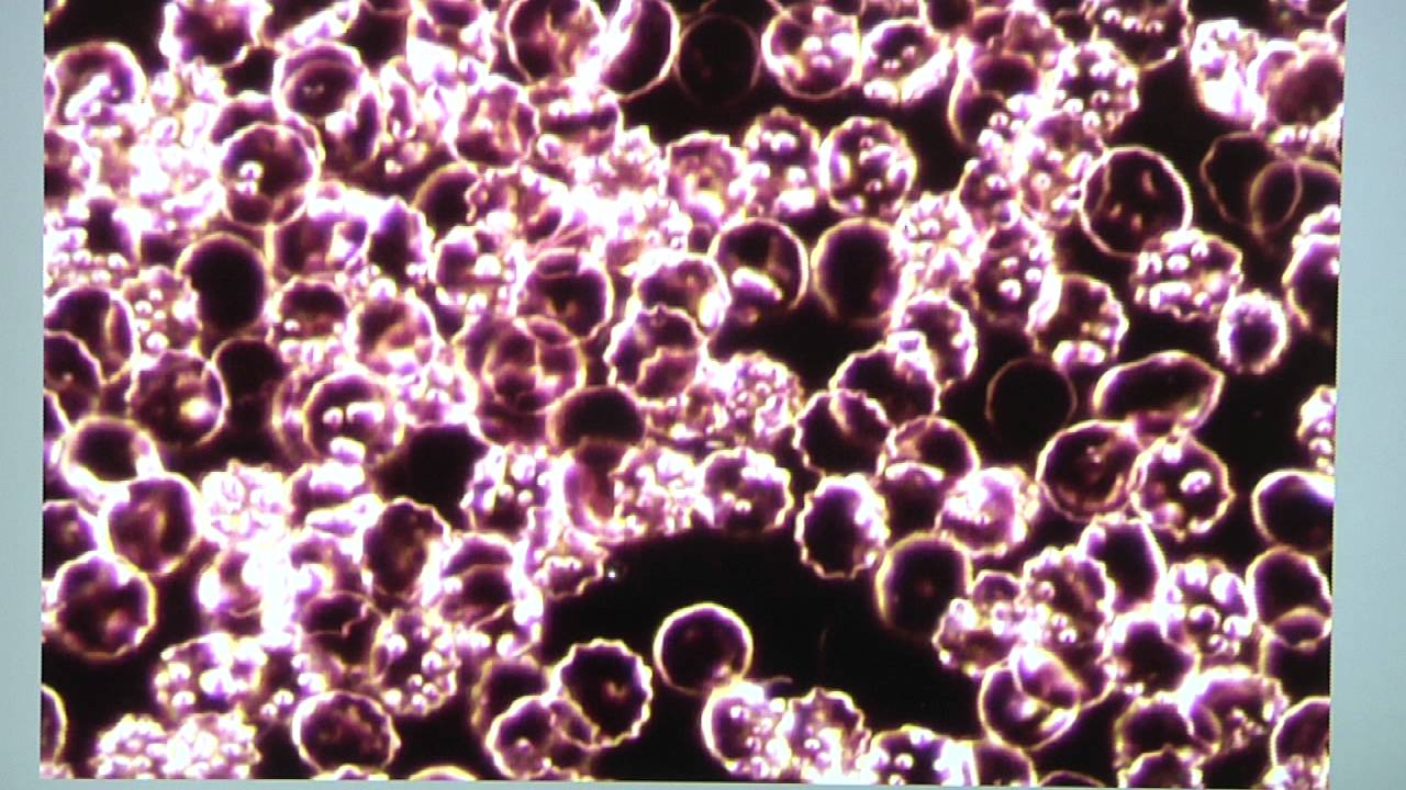 Live Blood Analysis