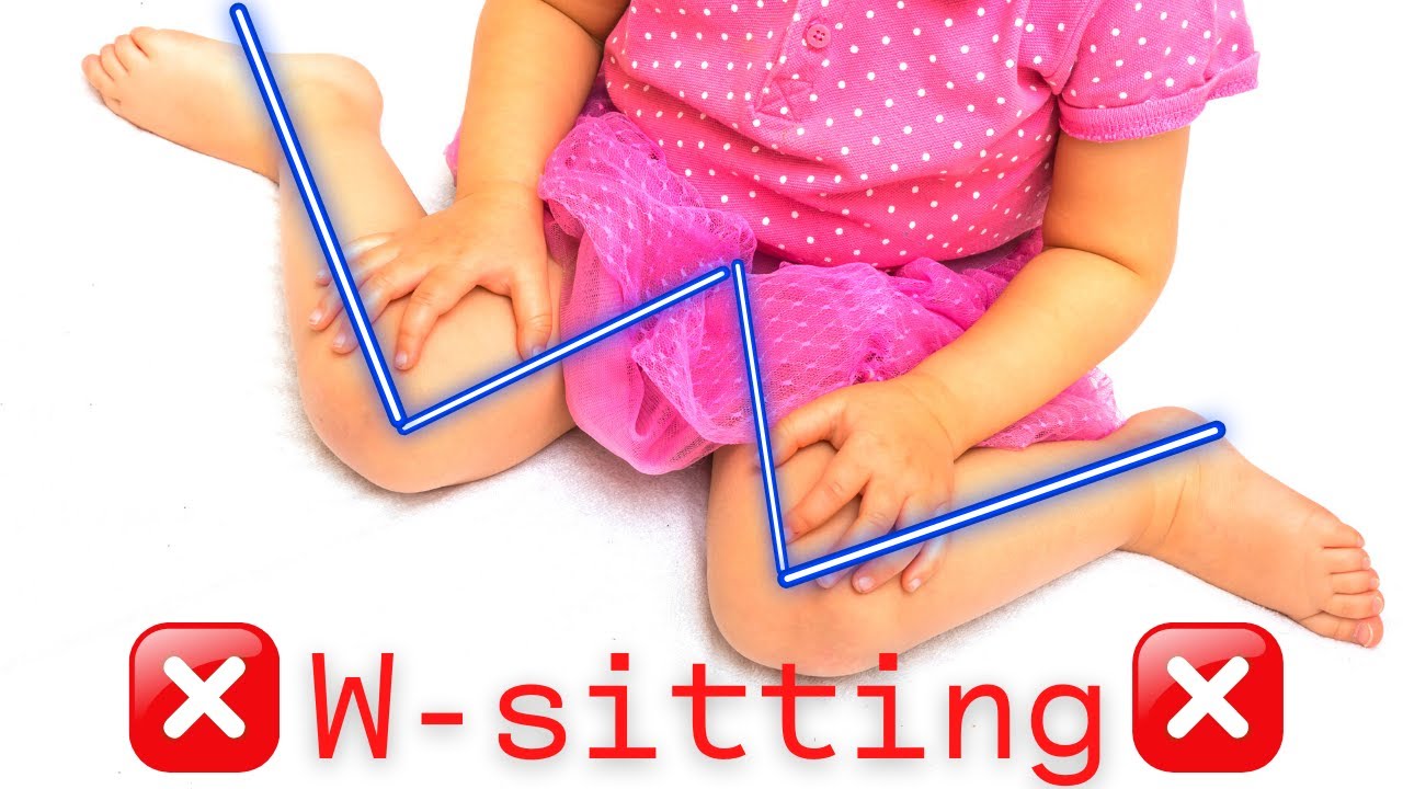 DON'T LET YOUR BABY SIT LIKE THAT! W-SITTING DANGERS ⛔