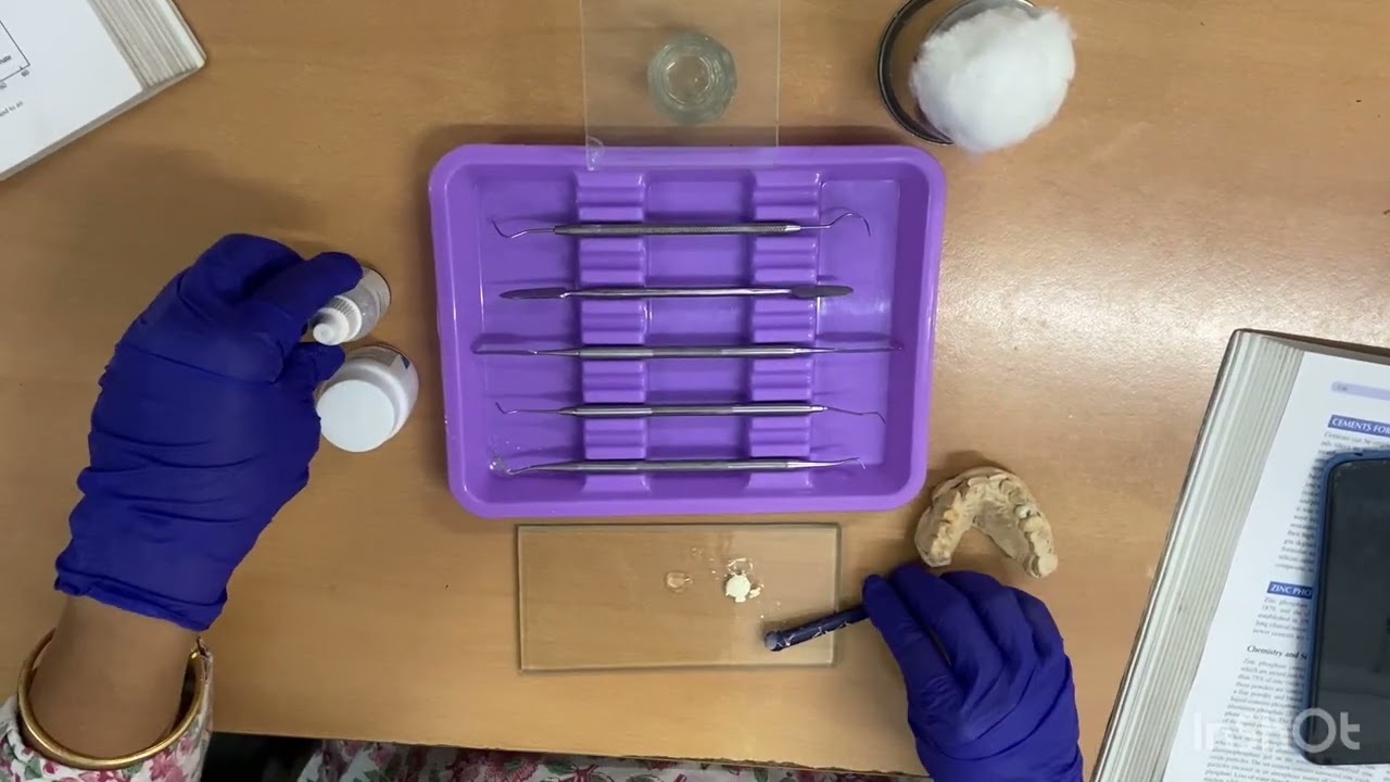 Mixing of zinc phosphate cement for use as luting agent Dr Paromita Mazumdar 