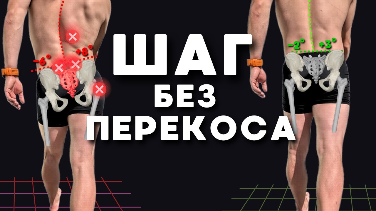 Каждый шаг с перекосом таза — это удар в поясницу. Время исправить походку.