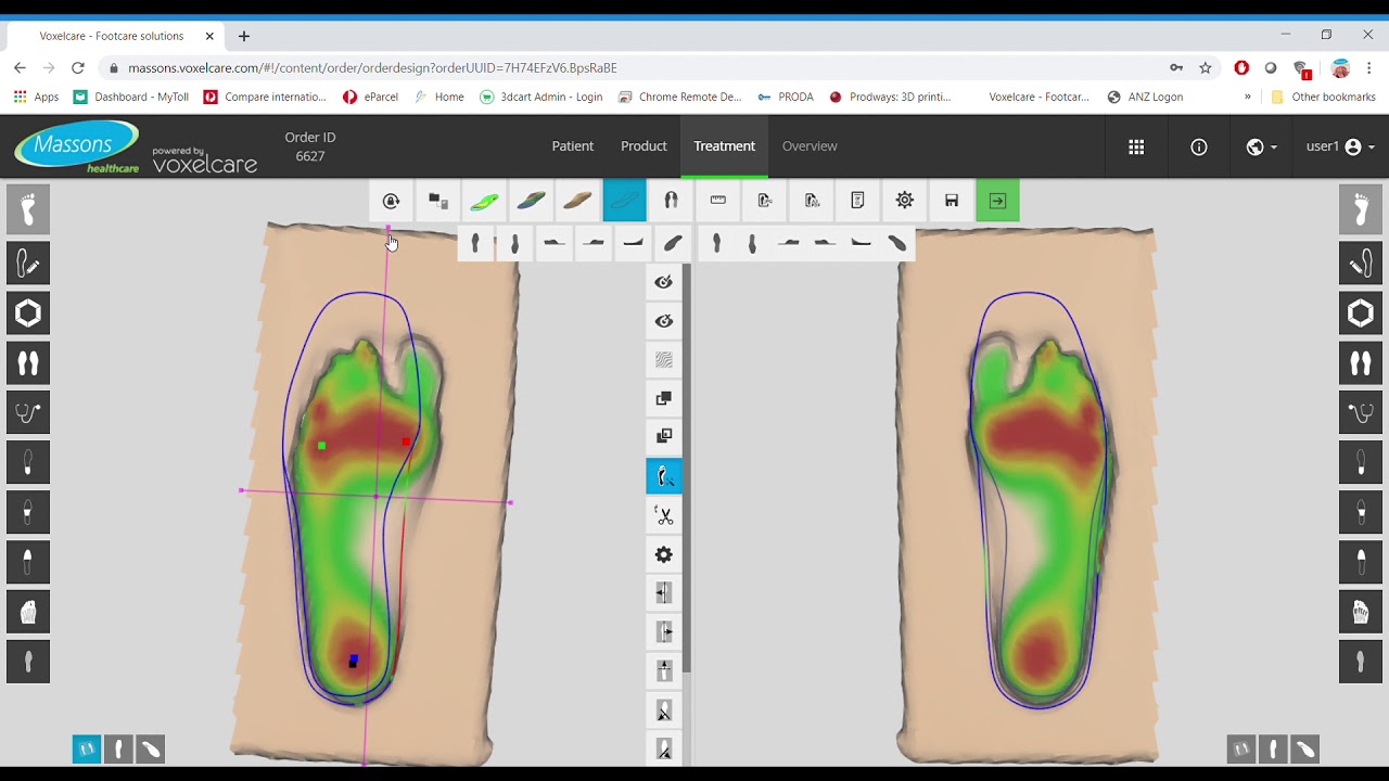 Voxelcare CAD CAM from start to finish