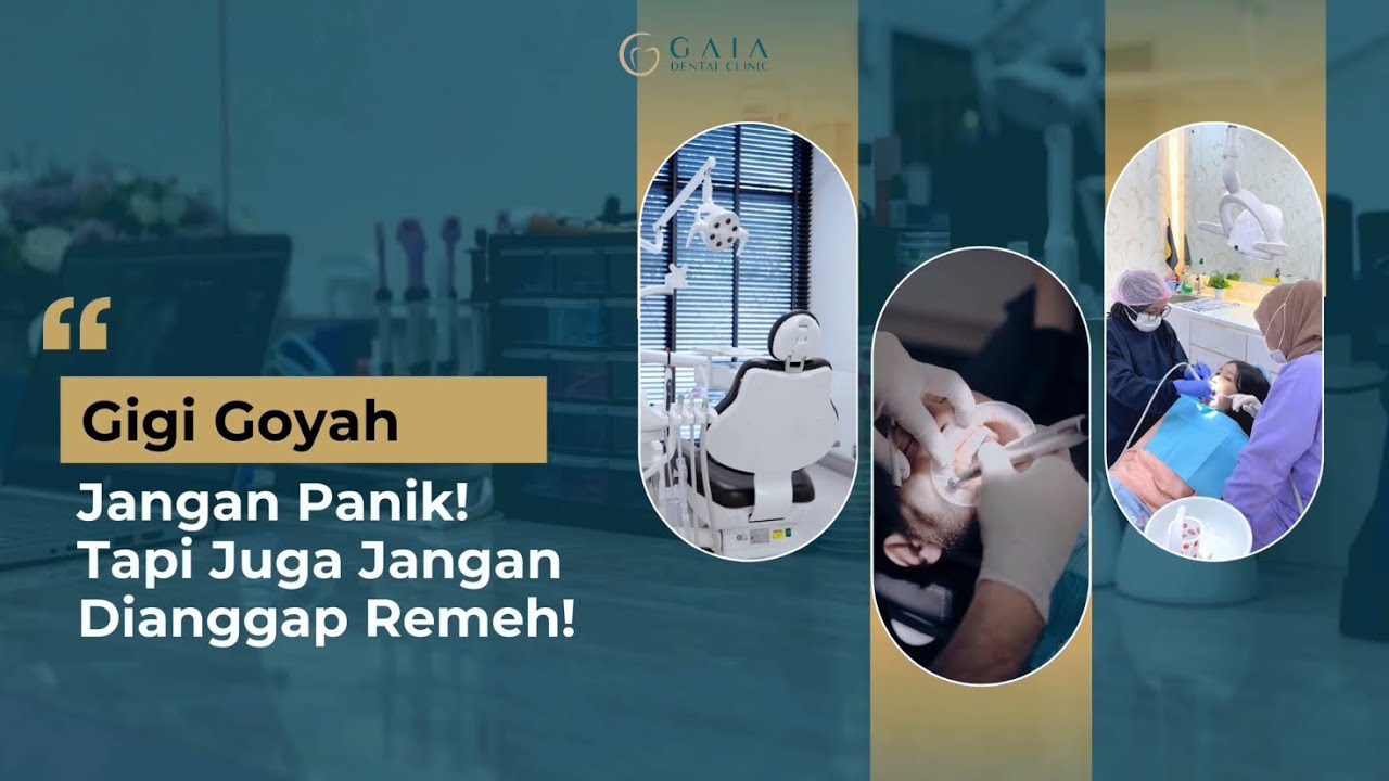 Gigi Goyah, Jangan Panik! Tapi Juga Jangan Dianggap Remeh
