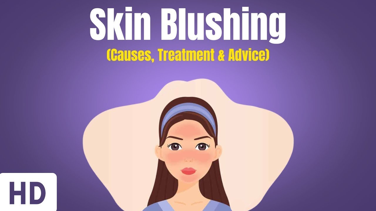 Skin Flushing or Blushing: Everything You Need To Know