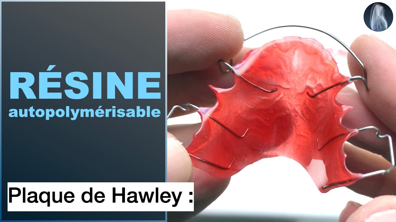 Comment Concevoir une Base Résine pour une Plaque de Hawley | Guide Complet étape par étape