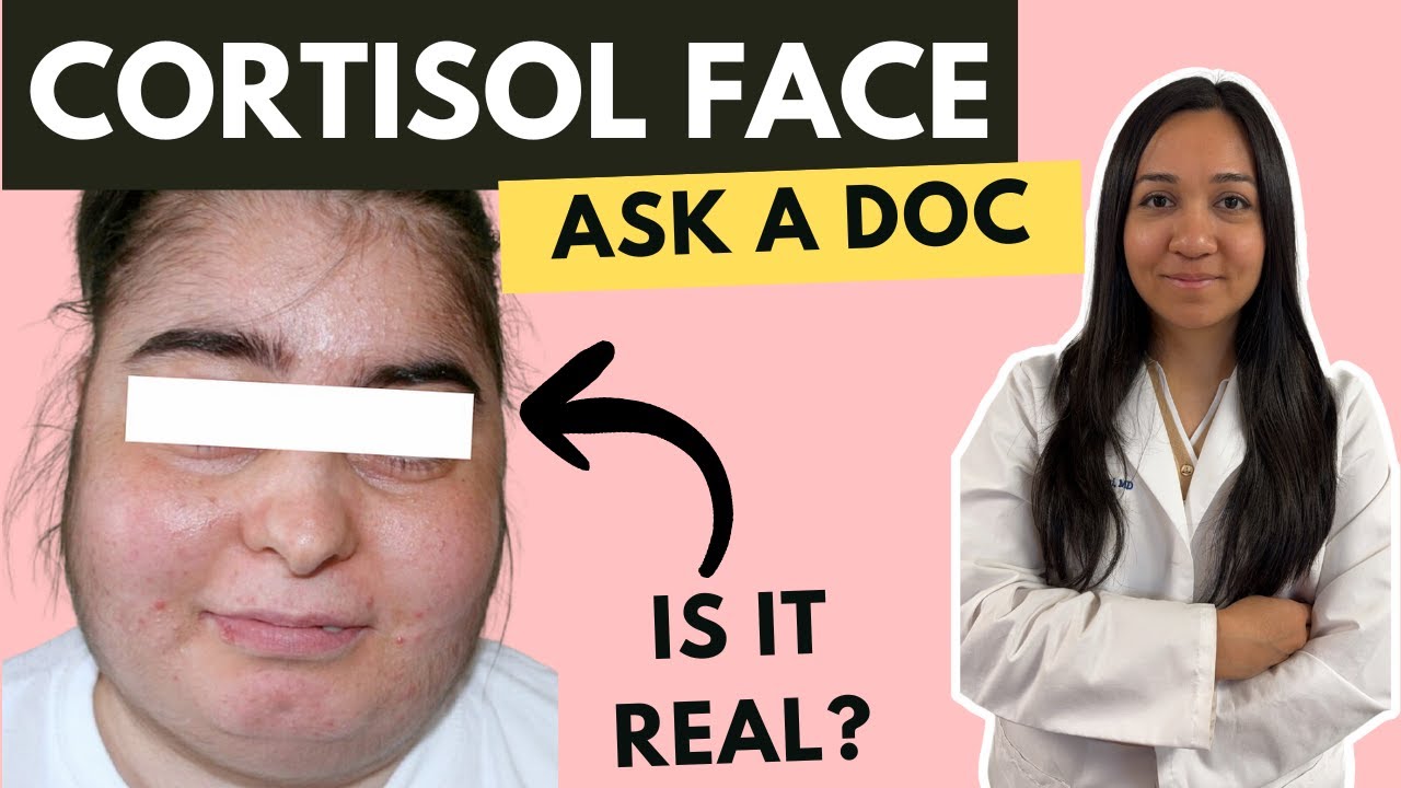 The truth about cortisol face | doctor explains