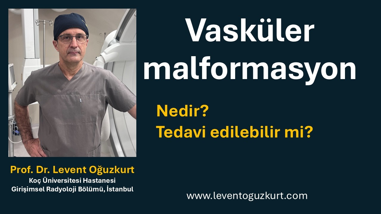 Vasküler malformasyon
