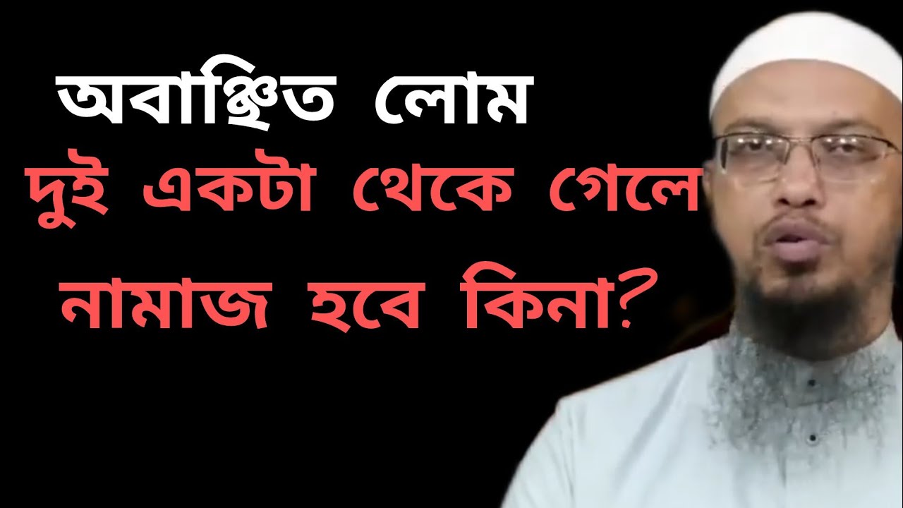 অবাঞ্ছিত লোম দুই একটা থেকে গেলে নামাজ হবে কিনা?শায়খ আহমাদুল্লাহ