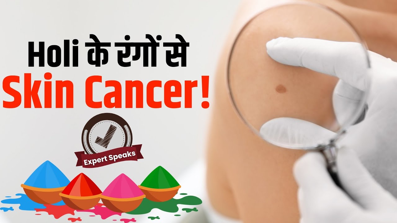 Holi Skin Cancer: होली के किन रंगों से हैआपको स्किन कैंसर का खतरा?