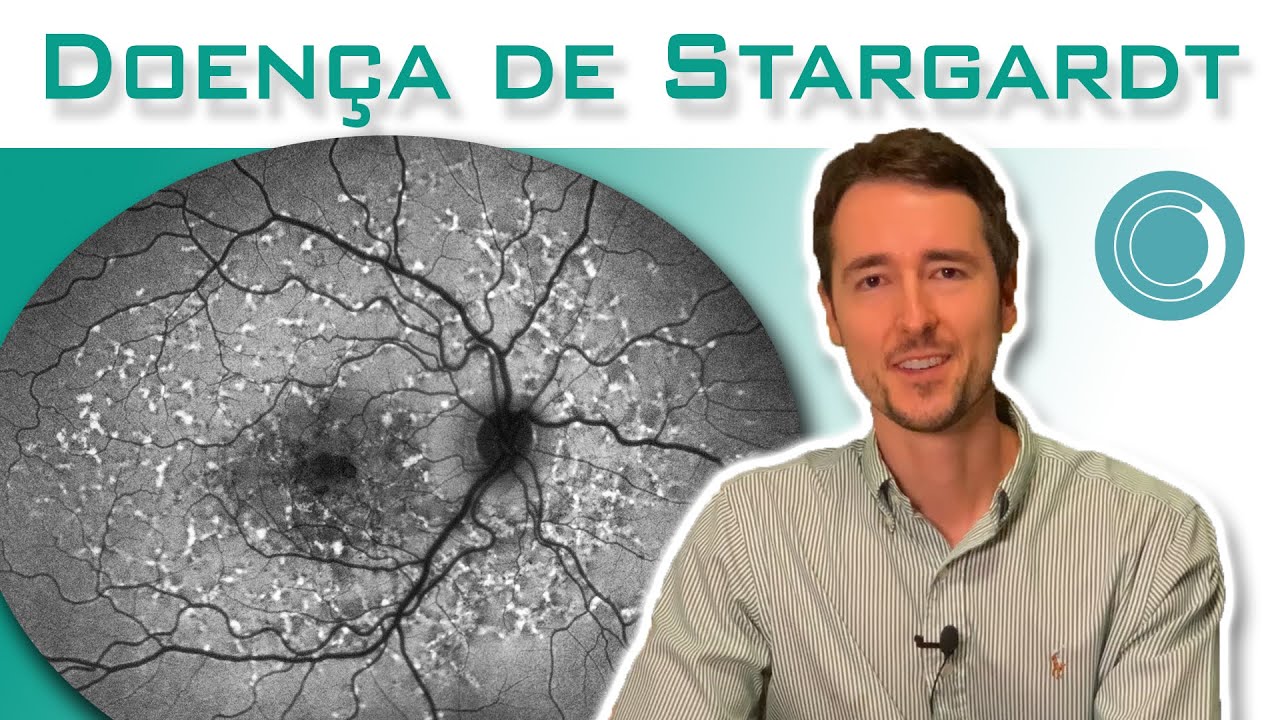Doença de Stargardt - sintomas, diagnóstico e tratamento
