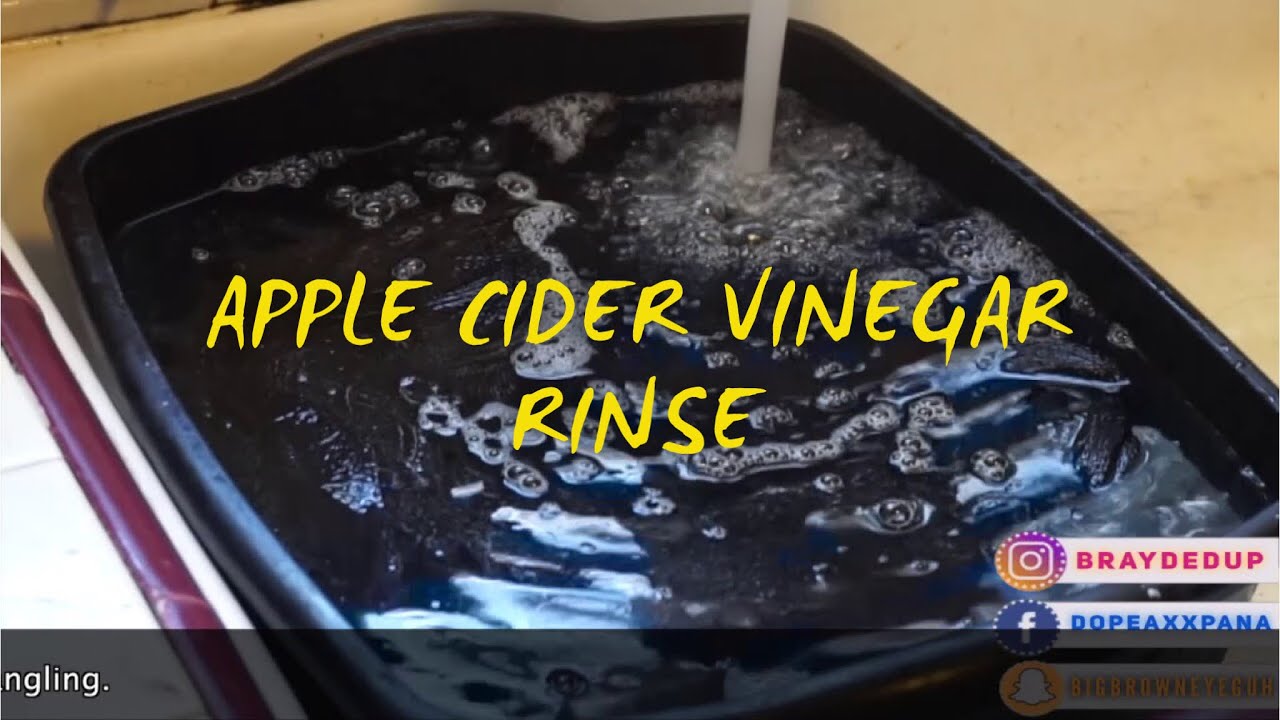 How To Prevent Itchy Braids| ACV Rinse
