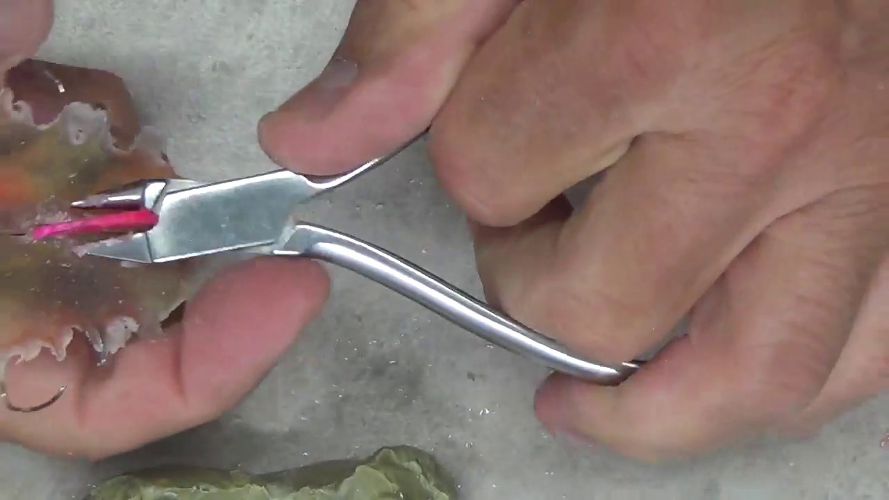 Placa con tornillo de expansión. Parte 9. Dr. Eduardo Menchaca Flores.