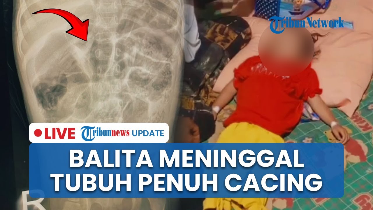 🔴 LIVE: Balita di Sukabumi Meninggal dengan Kondisi Tubuh Penuh Cacing, ibu ODGJ sementara Ayah TBC