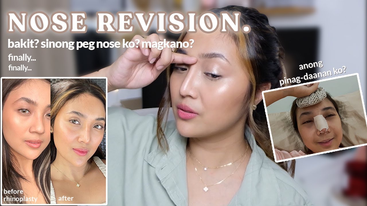 MY NOSE JOB REVISION STORY! | Random Kwento + Lutang Surgery Day Vlog LOL | Via Silverio