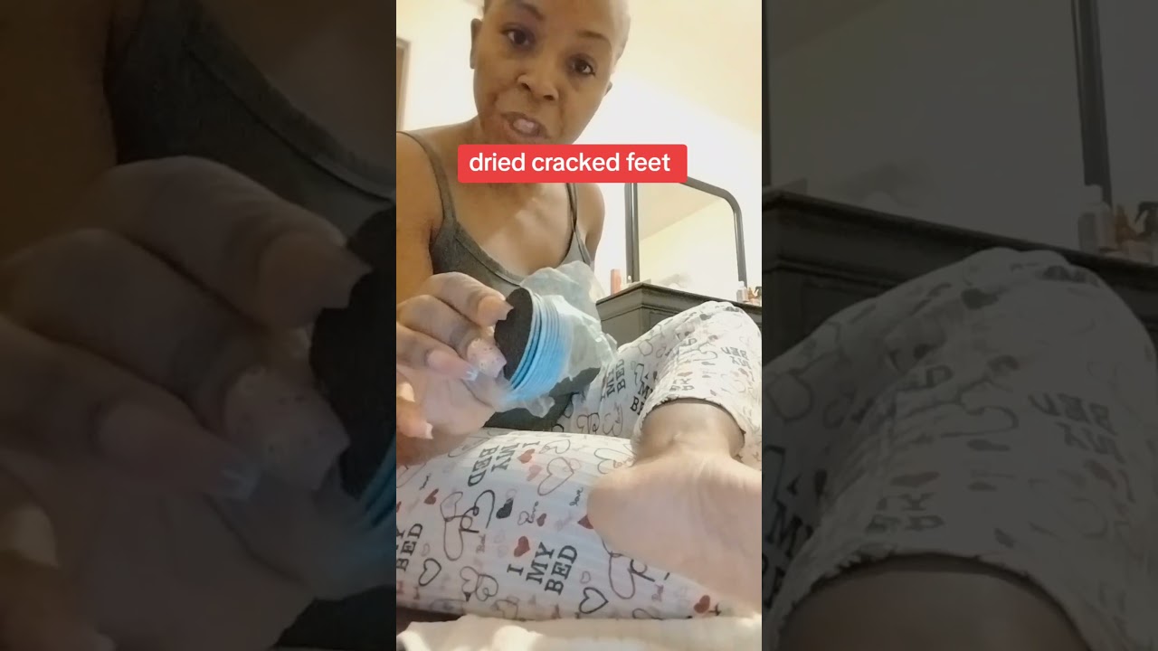 Этот прибор для ног быстро удаляет омертвевшую кожу | Вирусный обзор продукта в TikTok