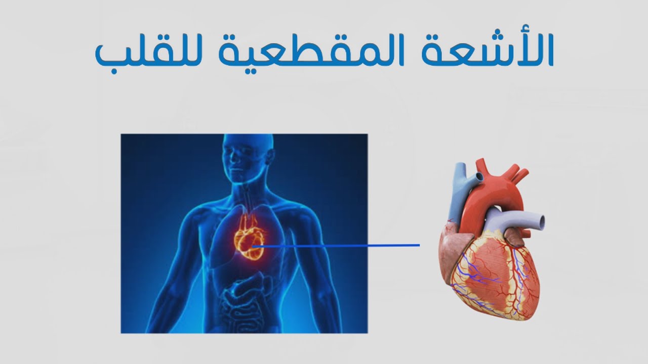 الأشعة المقطعية للقلب