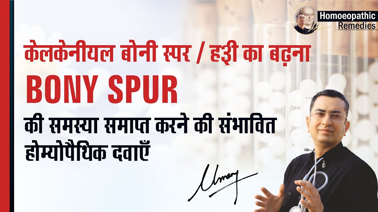 पैर के तलवे की हड्डी बढ़ने || Bony Spur || Homeopathic remedies with symptoms || होम्योपैथिक उपचार