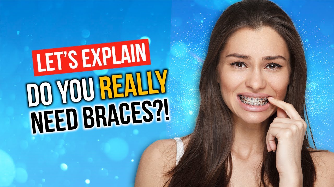 Do You Really NEED Braces?!