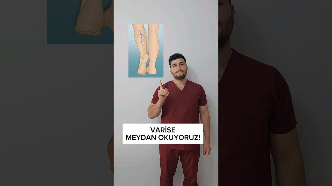 Varise Meydan Okuyoruz! #Varis #varistedavisi #varisegzersizi #fizyoterapist #fiziktedavi