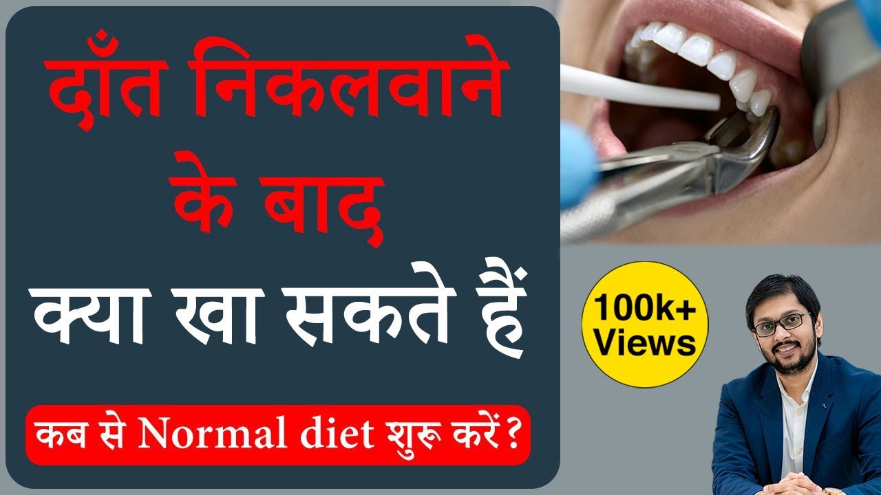 दांत निकलवाने के बाद क्या खाएं | What to eat after teeth extraction | Diet after tooth removal