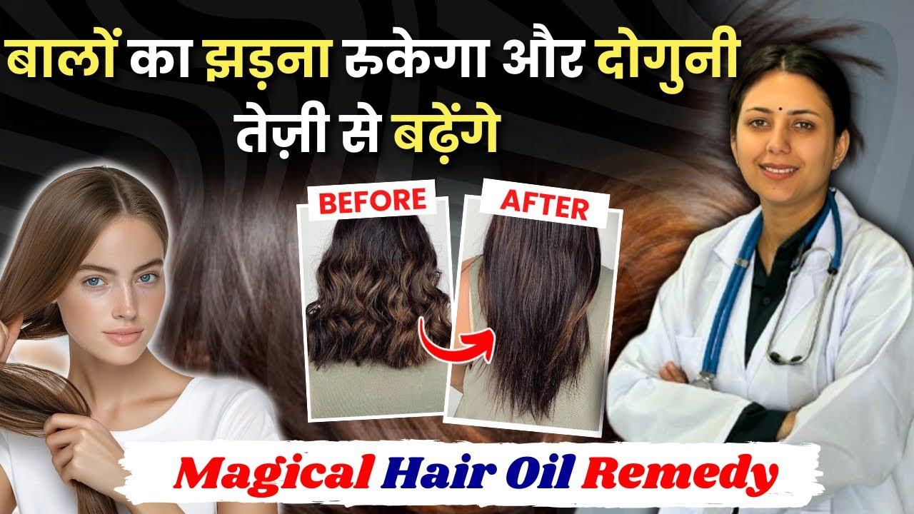 बरसात में Hairfall नहीं अब सिर्फ Hair Growth होगी | Magical Hair Growth Oil | Hairfall Home Remedy