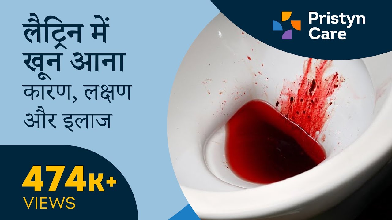 लैट्रिन में खून आना - कारण, लक्षण और इलाज | Blood in Stool| For Free appointment call: 08065-417-722