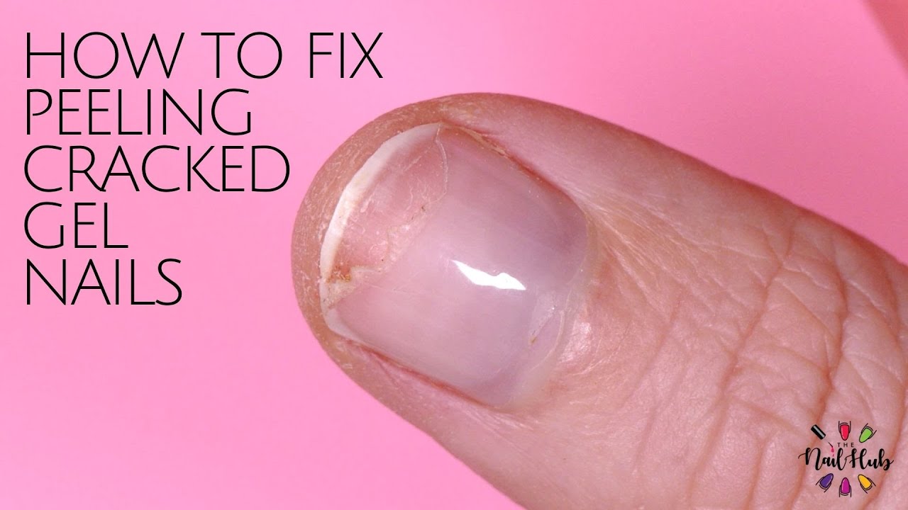 How to Repair Peeling Chipped Gel Nails