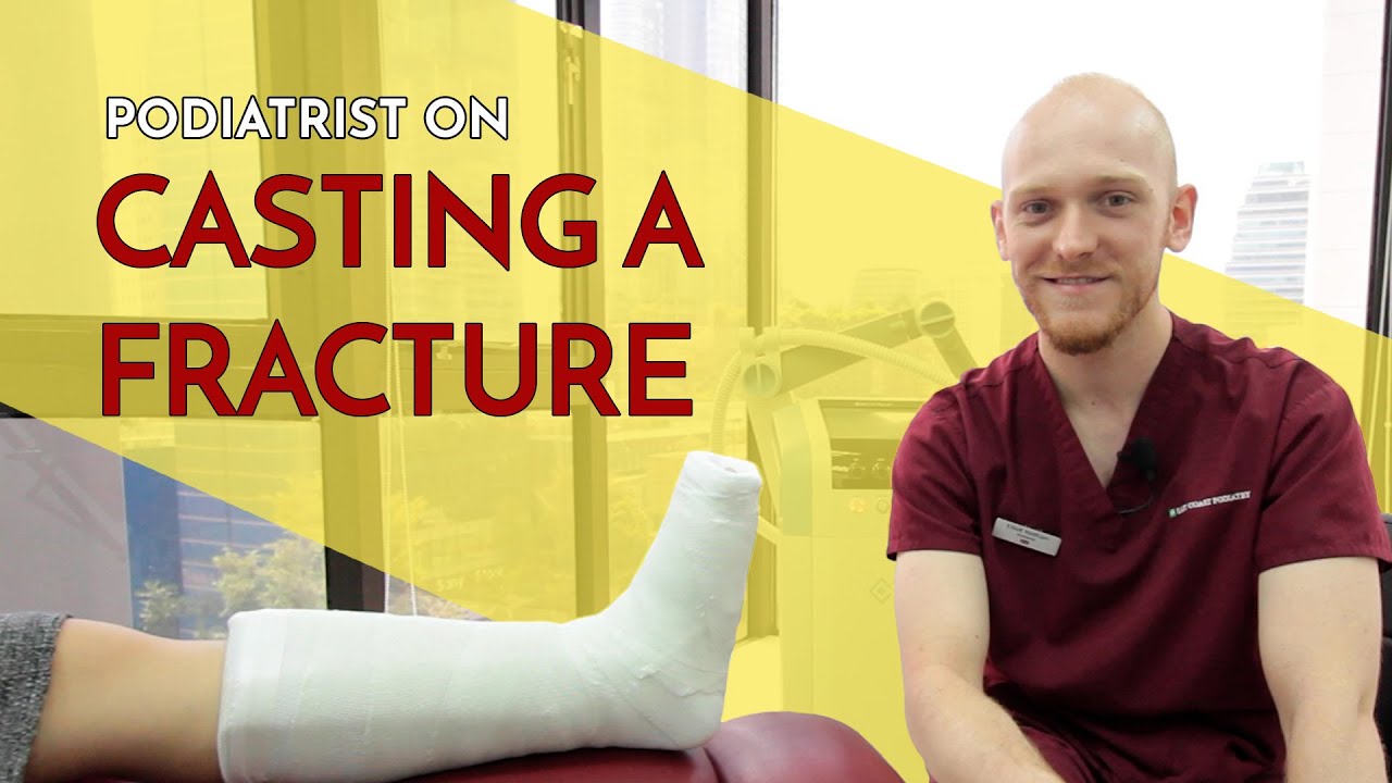 Casting fractures on the foot or ankle - Senior Podiatrist Elliott Yeldham, East Coast Podiatry