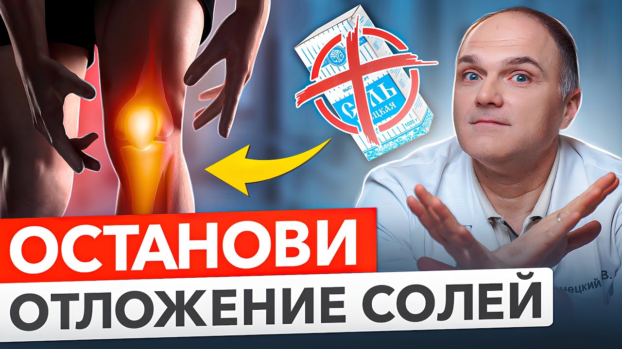 Как убрать отложение солей в суставах? Причины, лечение, мифы.