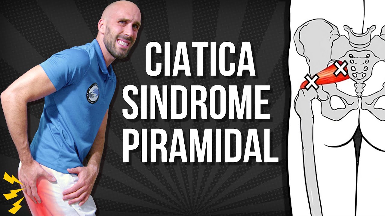 9 EJERCICIOS para la CIATICA POR SINDROME DEL PIRAMIDAL #fisioterapiatualcance