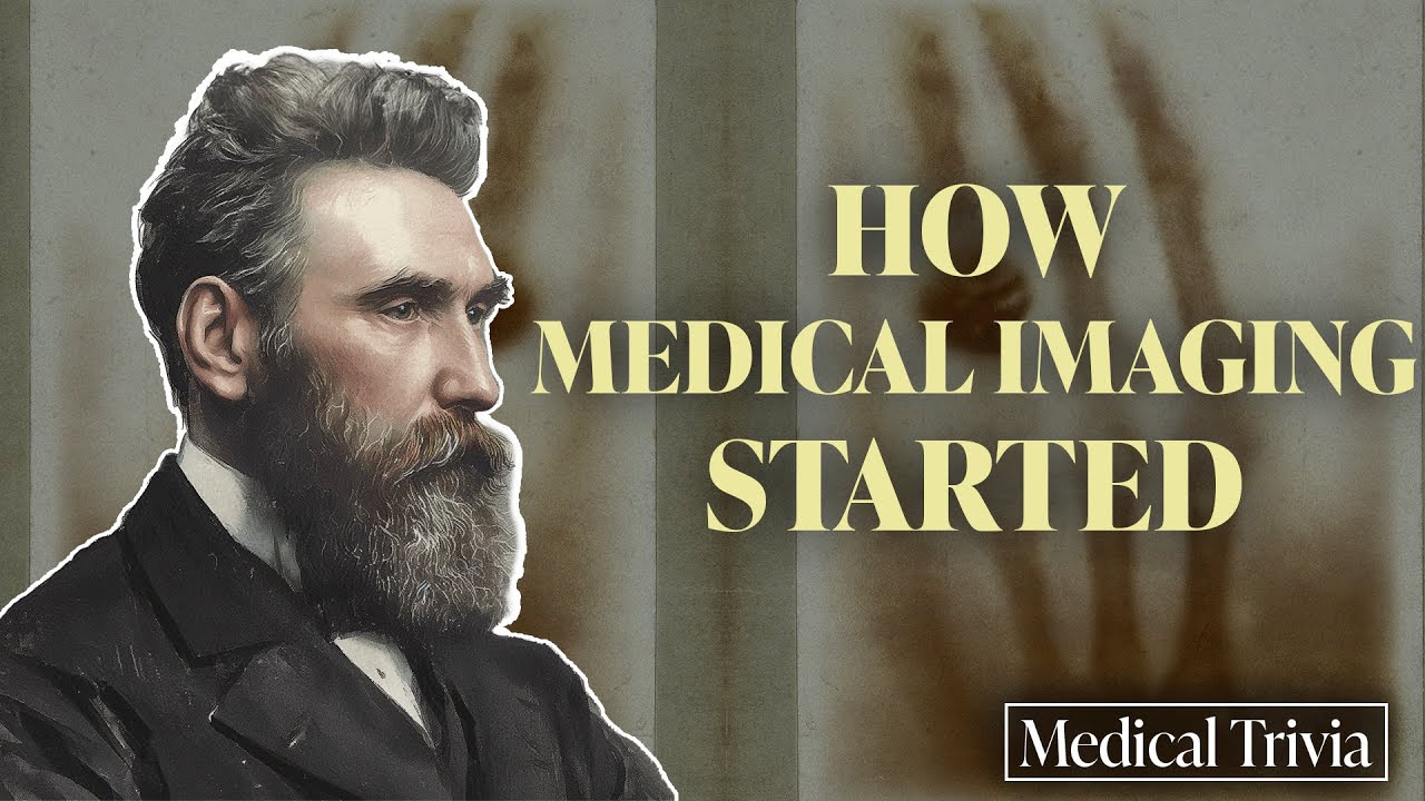 From Rontgen to Radiology: The History of X-Rays and Its Applications