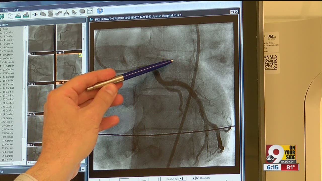 How this man survived 'widow maker' heart attack