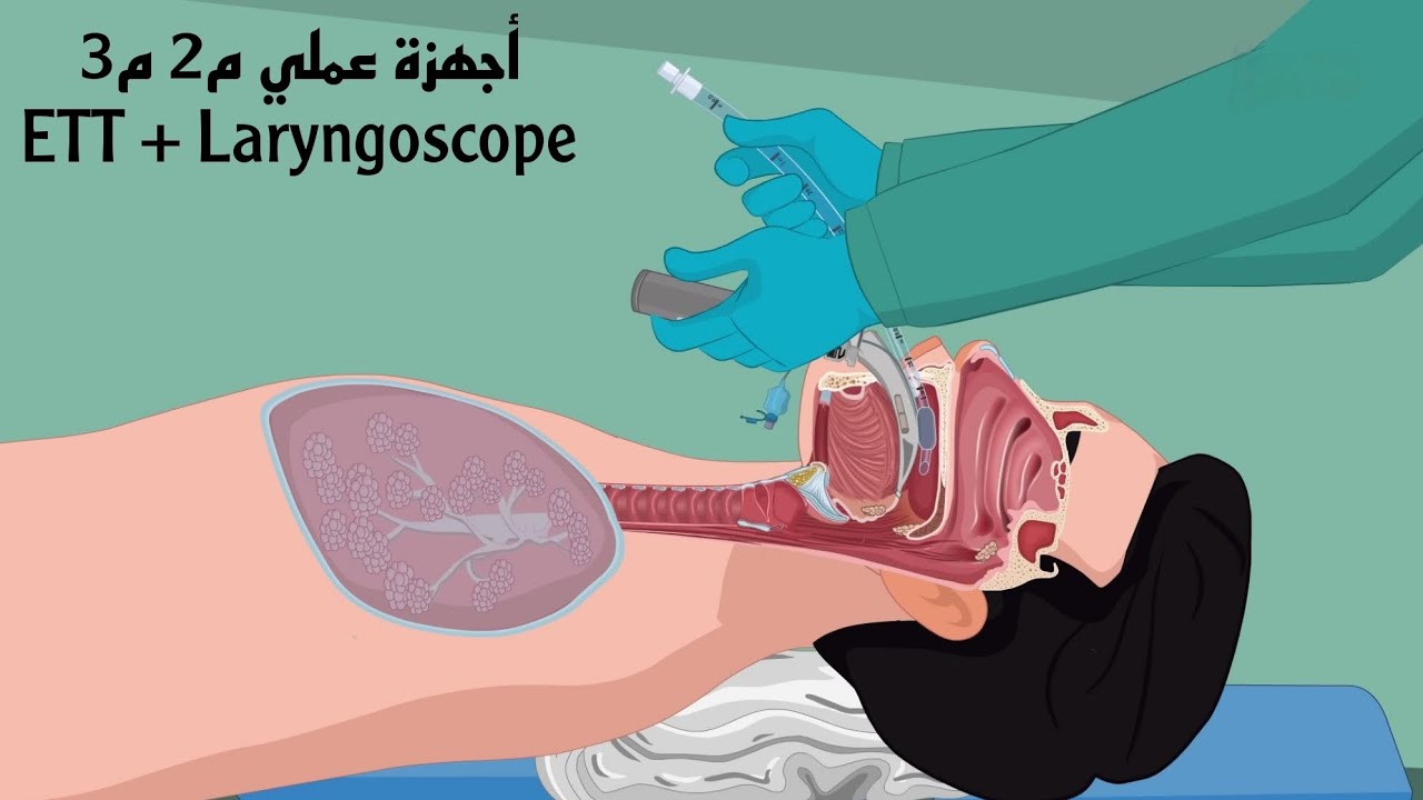 أجهزة عملي م2 م3 ك1 | مرحلة ثالثة تخدير | ETT + Laryngoscope 
