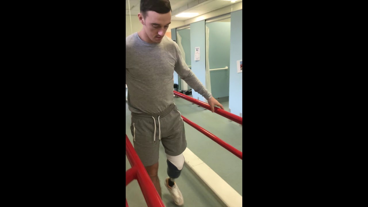 My Amputation Journey | First Prosthetic Leg
