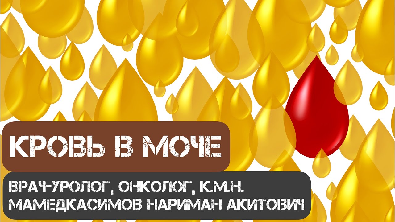 Кровь в моче! Что делать? Врач-уролог, онколог, к.м.н. Мамедкасимов Нариман Акитович