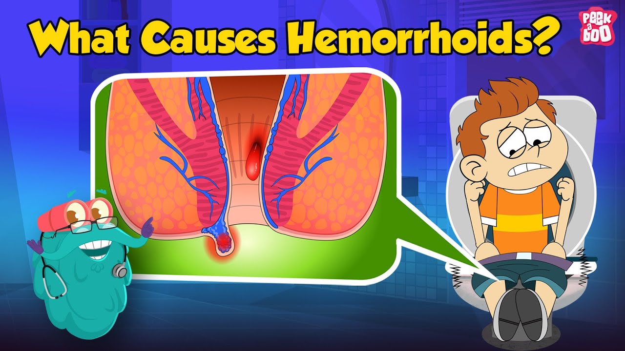 What are Piles? | What Causes Hemorrhoids? | Hemorrhoids: Symptoms and Prevention | Dr. Binocs Show