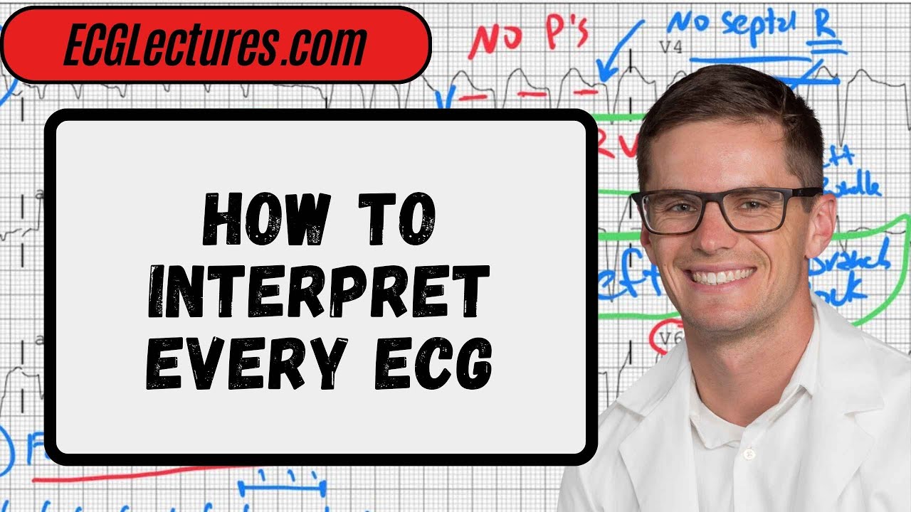 Step-by-Step ECG Interpretation Guide