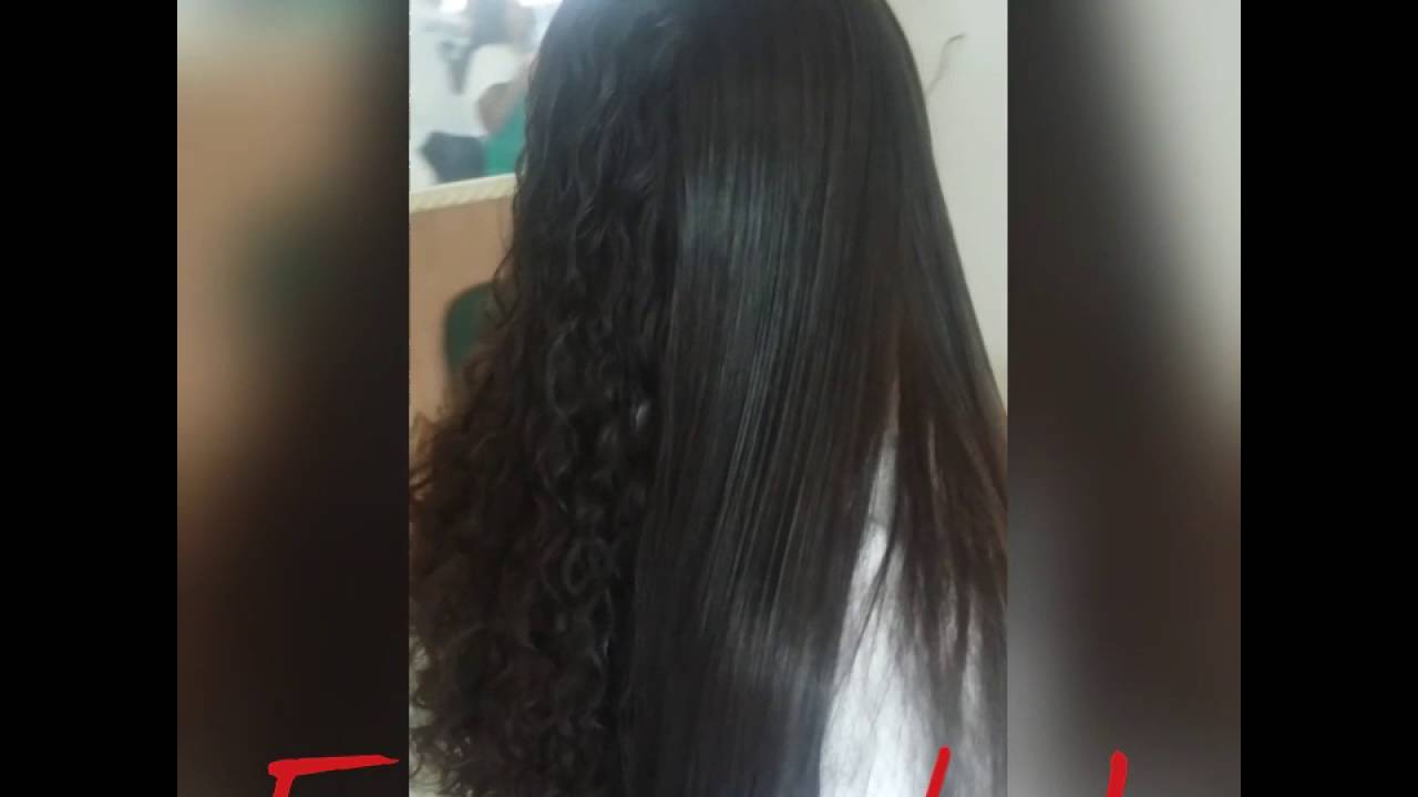 Tratamento redutor de volume SEM FORMOL