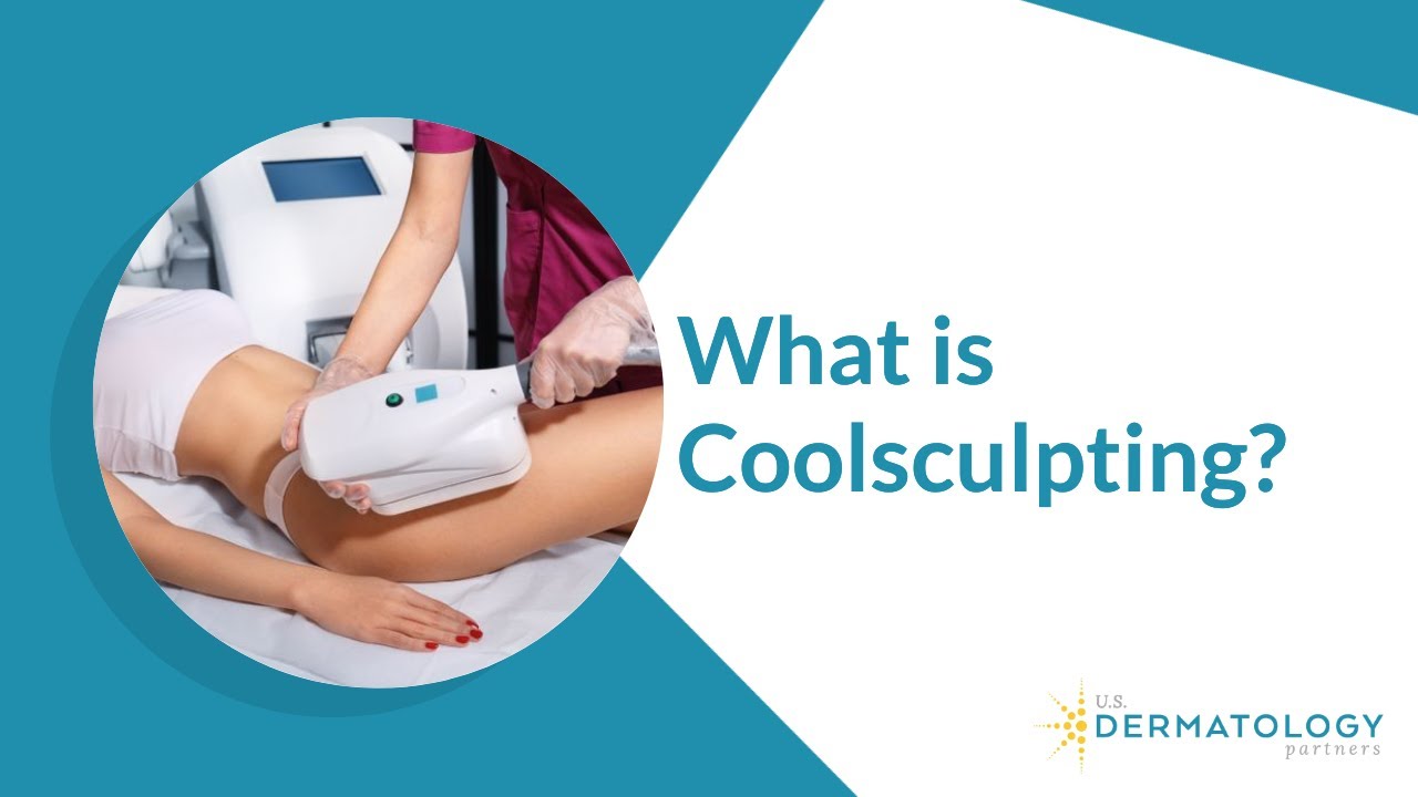What is Coolsculpting? | Freeze Away Body Fat